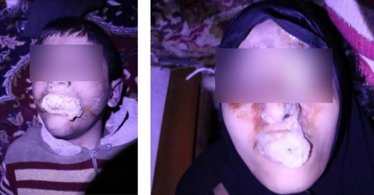 Αποδείξεις(;) από την Γαλλία για επίθεση με χημικά στην Συρία  – Εικόνες